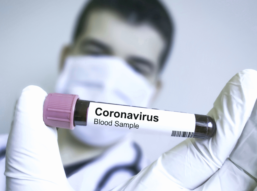 Corona Virus Information zur Erkrankung